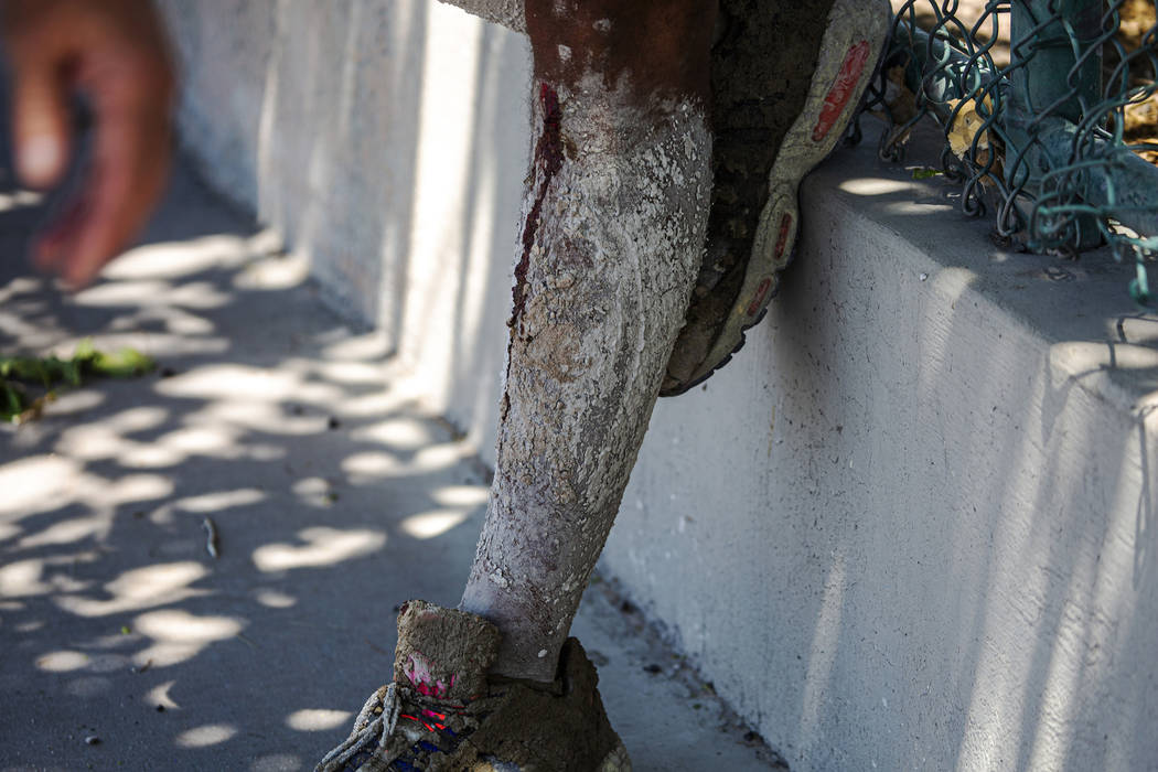 Las piernas de David Carnell están cubiertas de cemento después de ayudar a los niños herido ...