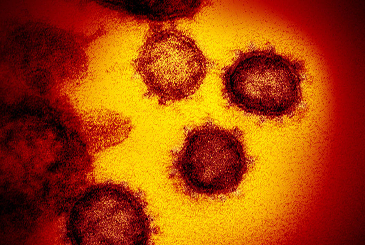 Esta imagen muestra el nuevo Coronavirus SARS-CoV-2. (NIAID-RML via AP)