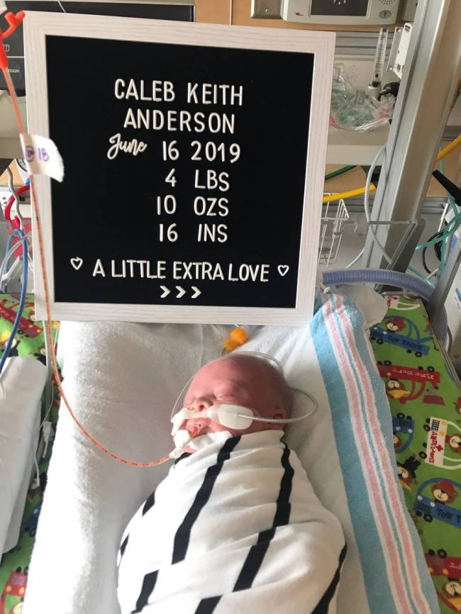 Caleb Anderson nació prematuramente a las 34 semanas. Los médicos dijeron que dejó de crecer ...