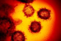 Esta imagen de microscopio electrónico sin fecha puesta a disposición por los Institutos Nacionales de Salud de EE. UU. En febrero de 2020 muestra el nuevo coronavirus SARS-CoV-2. También conocido como 2019-nCoV, el virus causa COVID-19. La muestra se aisló de un paciente en los EE. UU. (NIAID-RML a través de AP)