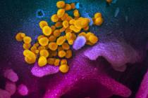 El nuevo coronavirus SARS-CoV-2, de color amarillo, emerge de la superficie de las células, az ...