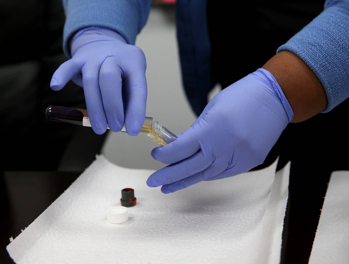El flebotomista Dana Duncan, de 37 años, separa el suero de la sangre durante la prueba volunt ...