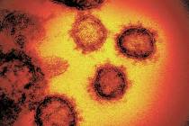 El nuevo coronavirus SARS-CoV-2, el virus causa el COVID-19. (Institutos Nacionales de Salud de ...