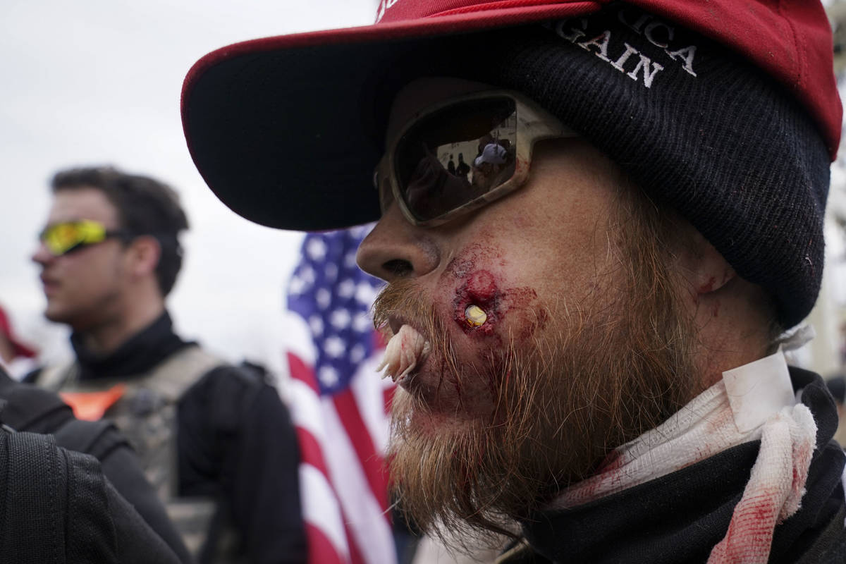 Se muestra a un manifestante herido durante un enfrentamiento con la policía el miércoles, 6 ...