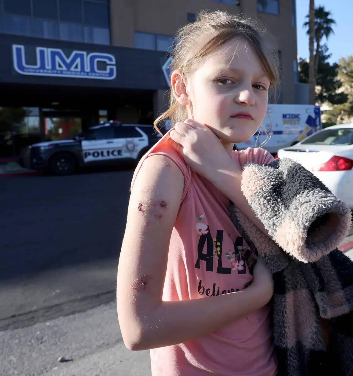 Paige Woodworth, de ocho años, muestra dónde le insertaron varillas de metal en el brazo ante ...