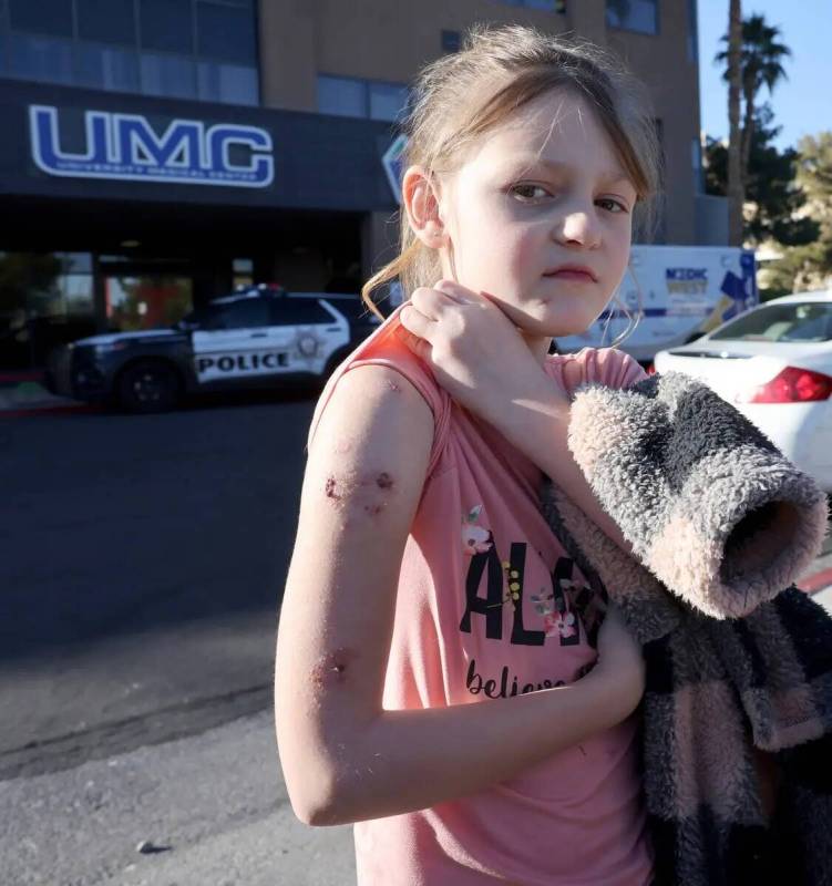 Paige Woodworth, de ocho años, muestra dónde le insertaron varillas de metal en el brazo ante ...