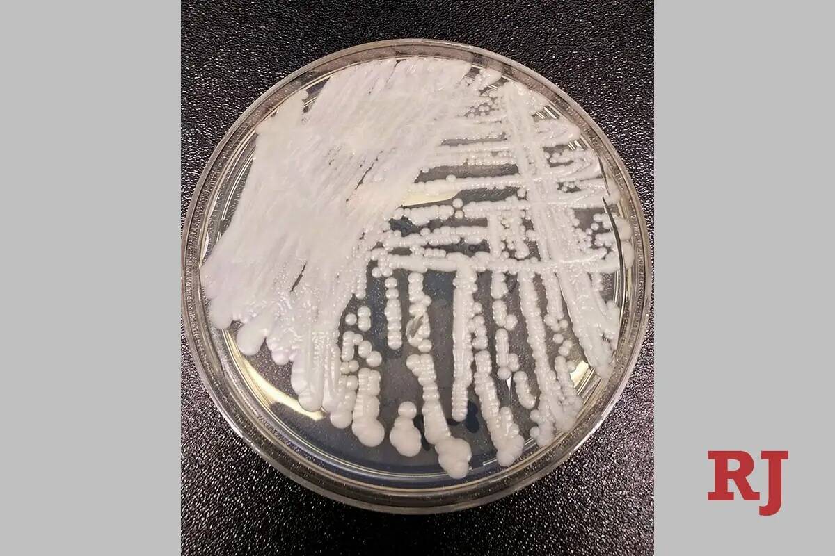 Esta foto muestra una cepa de Candida auris cultivada en una placa de Petri en un laboratorio d ...