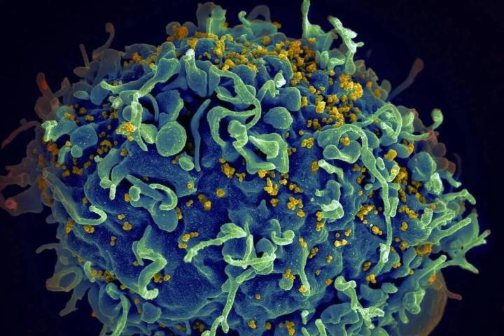 Virus VIH (amarillo) infectando una célula humana (Instituto Nacional del Cáncer)