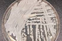Esta foto muestra una cepa de Candida auris cultivada en una placa de Petri en un laboratorio d ...